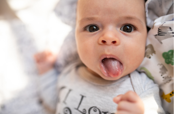 Newborn's Tongue Is White