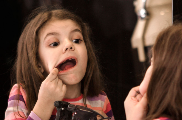 Mouth Ulcers in Children