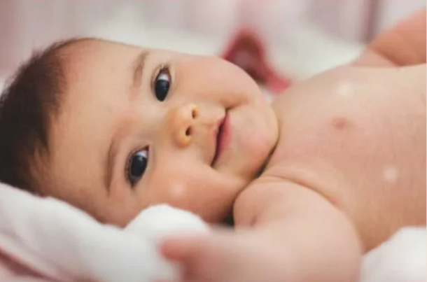 Is It Normal for Newborns to Have Rashes