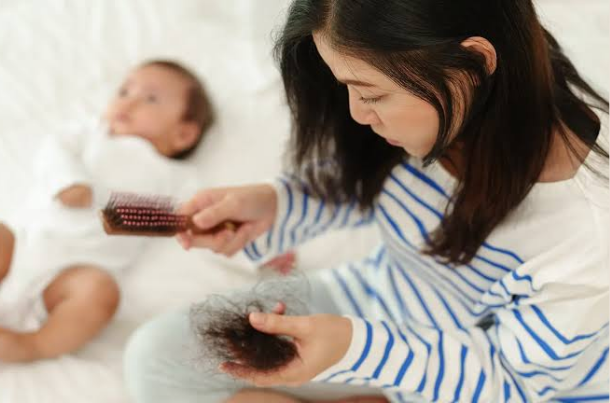 postpartum hair loss